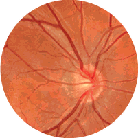 Retinografia
