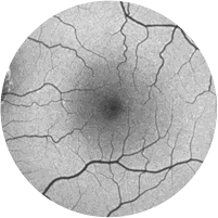 Retinografia Autofluorescente