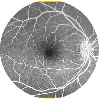 Angiografia Ocular